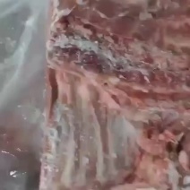 无颈前排