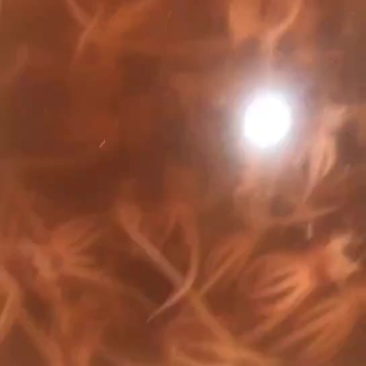 鱿鱼须