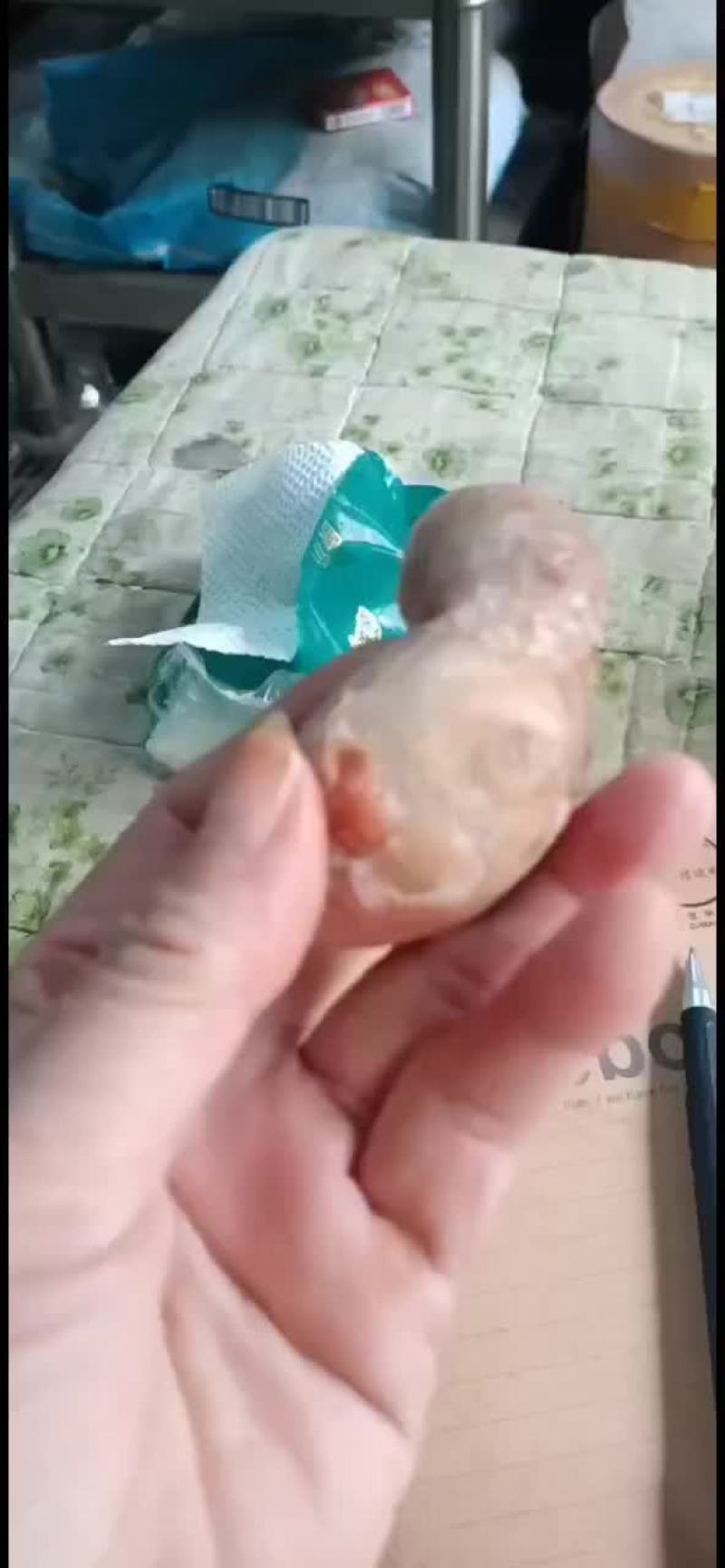 羊结石