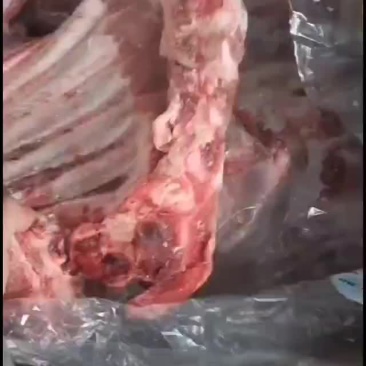 去颈前排
