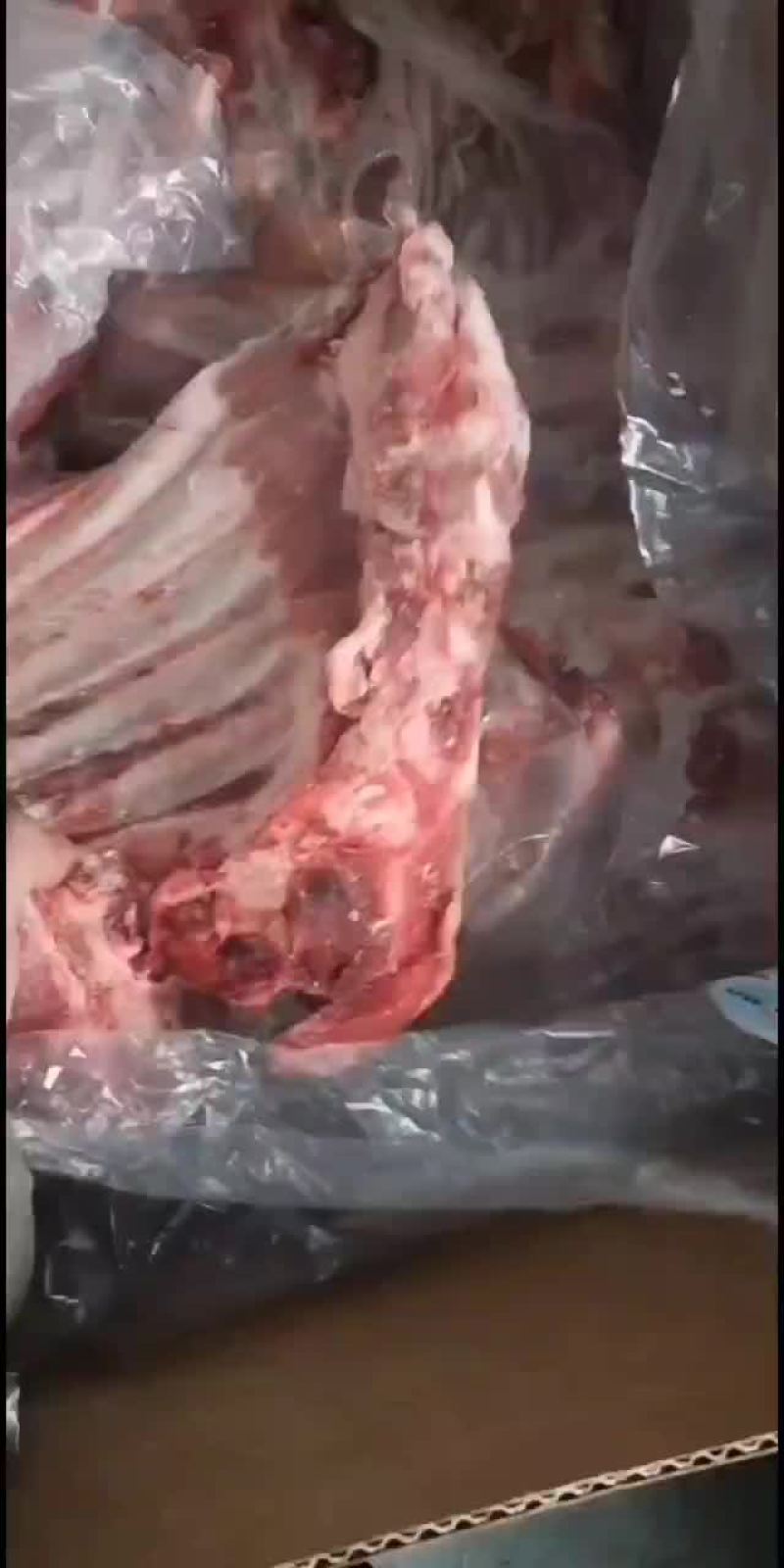 去颈前排