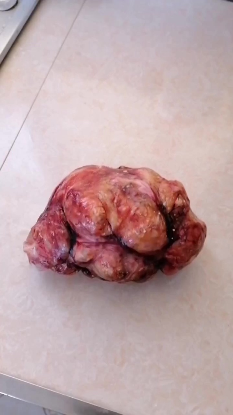 鸡宝
