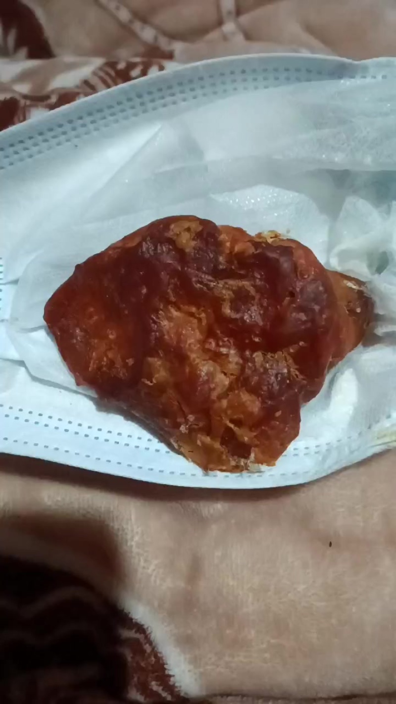 鸡宝