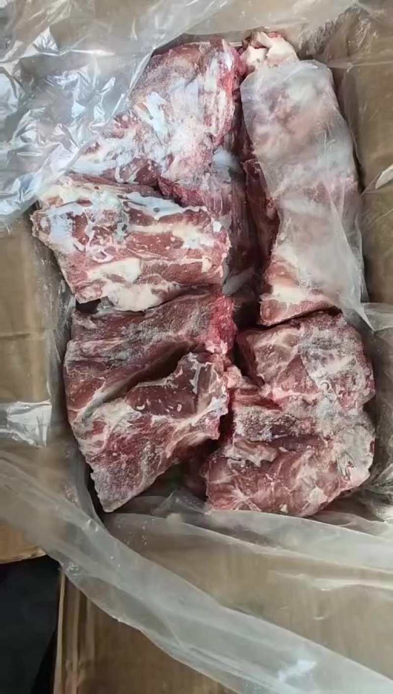 胫骨