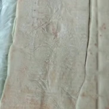 脊皮